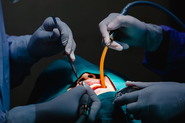 a patient's mouth in an operating room