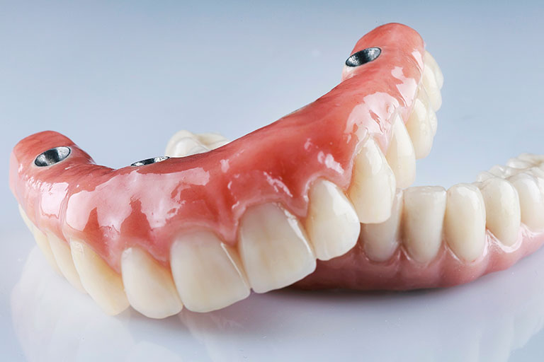 dentures